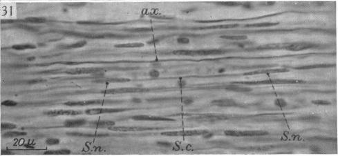 Fig. 31