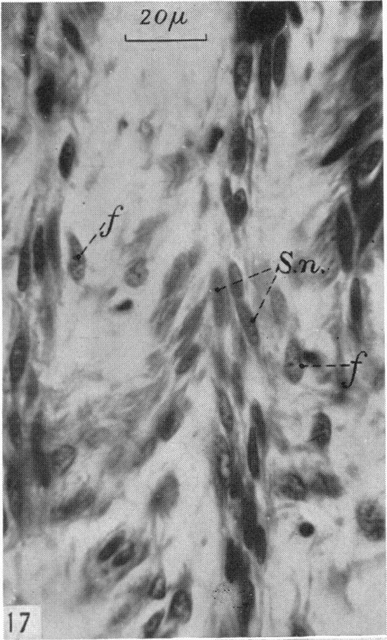 Fig. 17