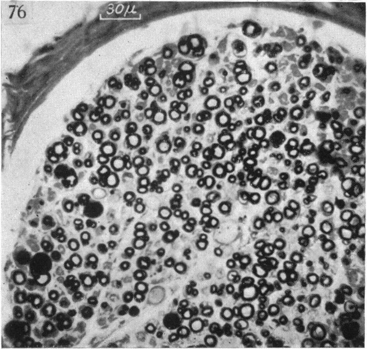 Fig. 76