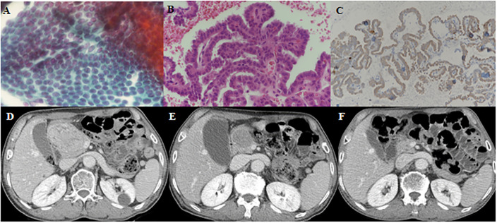 Fig 2