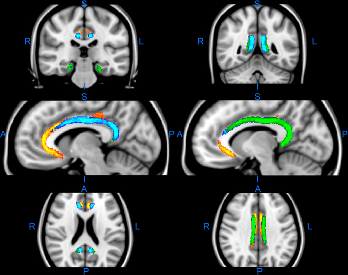 Fig. 4