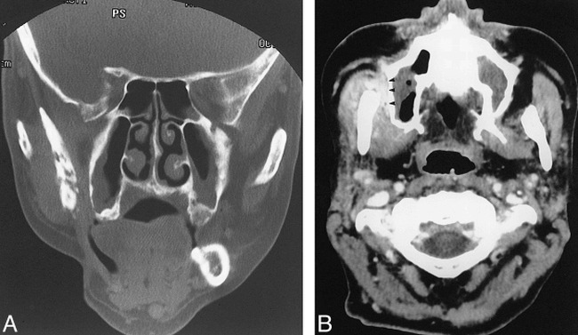 fig 2.