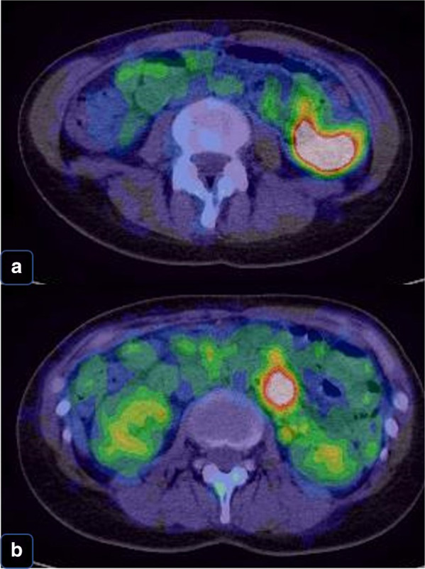 Fig. 3