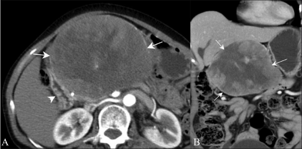 Figure 13 (A, B)