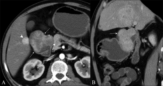 Figure 12 (A, B)