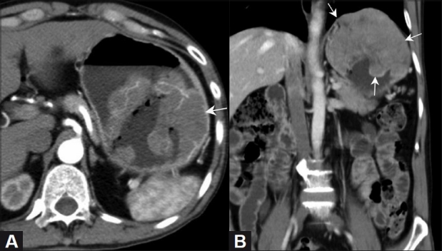 Figure 1 (A, B)