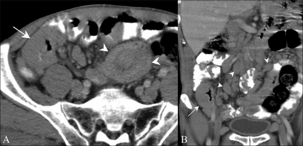 Figure 10 (A, B)