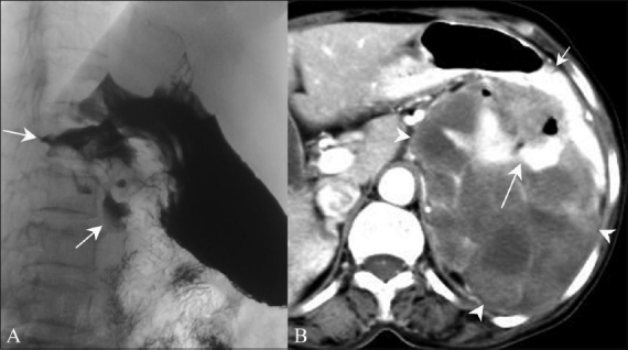 Figure 4 (A, B)