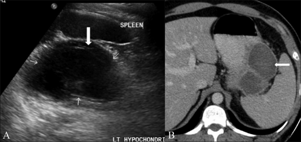 Figure 7 (A, B)