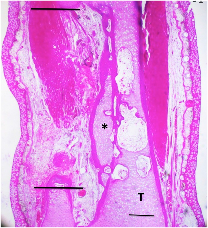 Fig 11