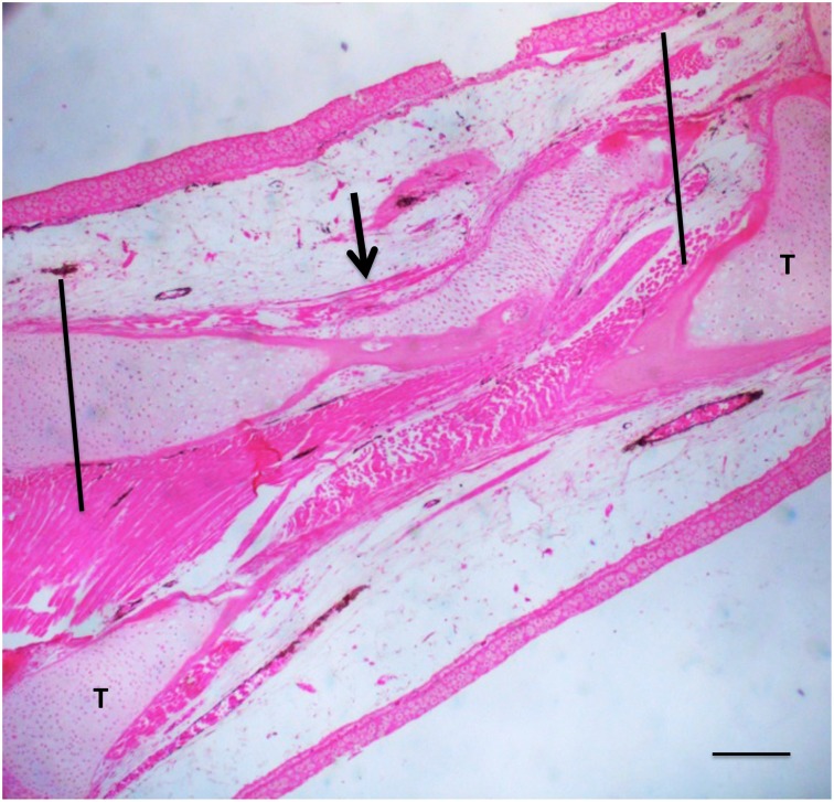 Fig 13