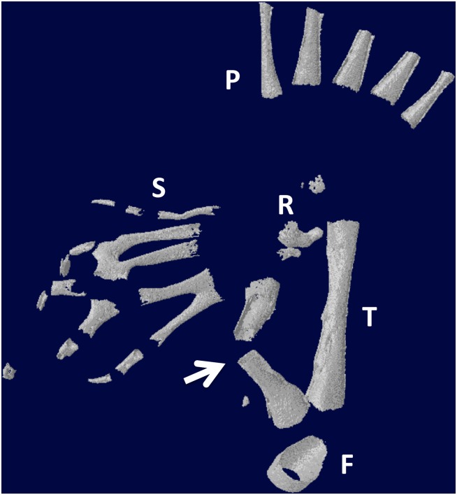 Fig 16