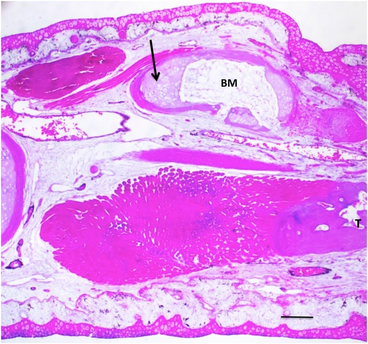 Fig 14