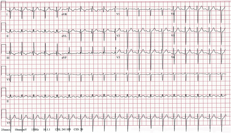 Figure 1