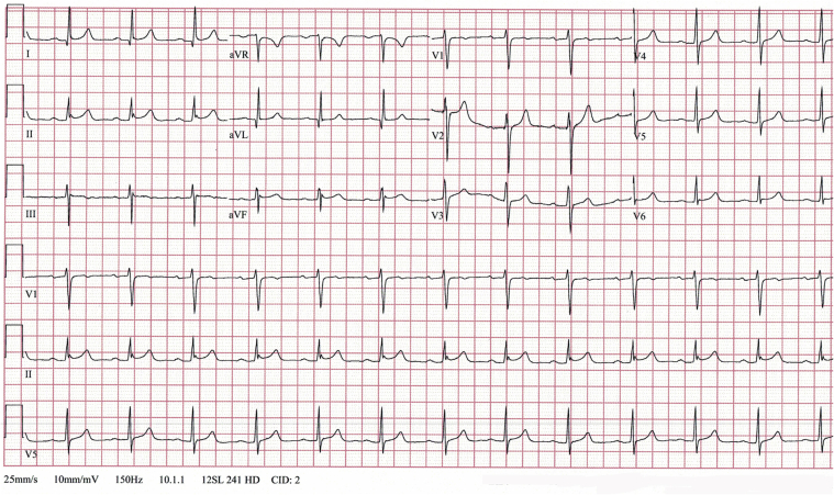 Figure 3