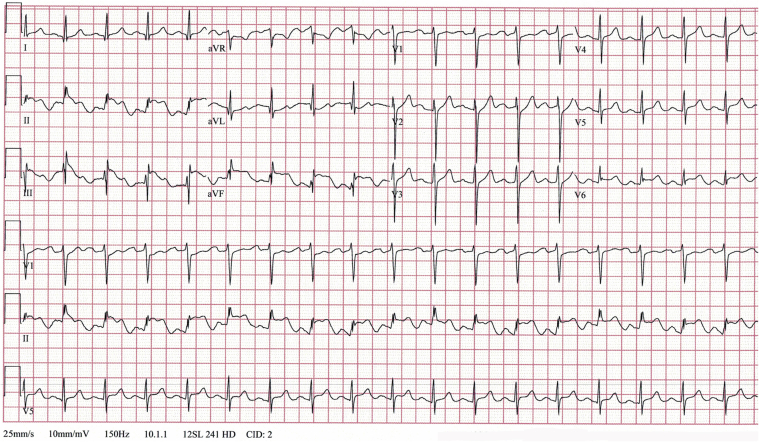 Figure 2