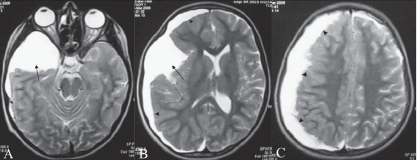 Figure 1 (A-C)