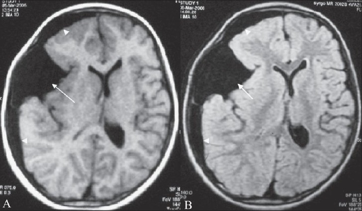 Figure 2 (A, B)