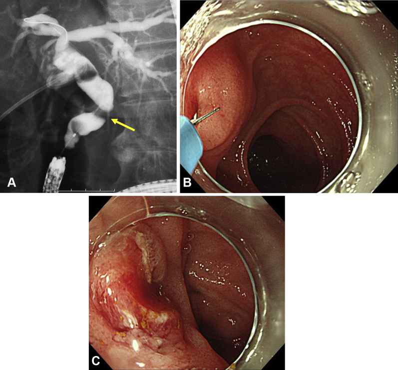 Figure 2