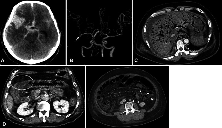 FIG. 2.