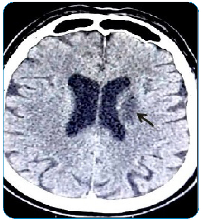 FIGURE 4: