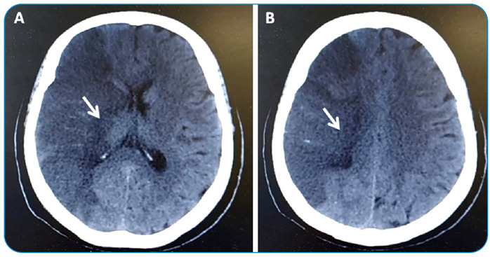 FIGURE 1(A and B):