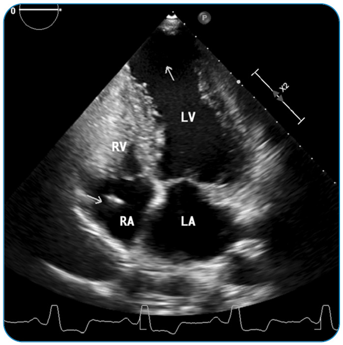 FIGURE 2: