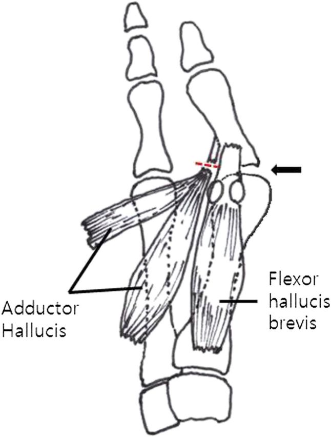 Fig. 3-E