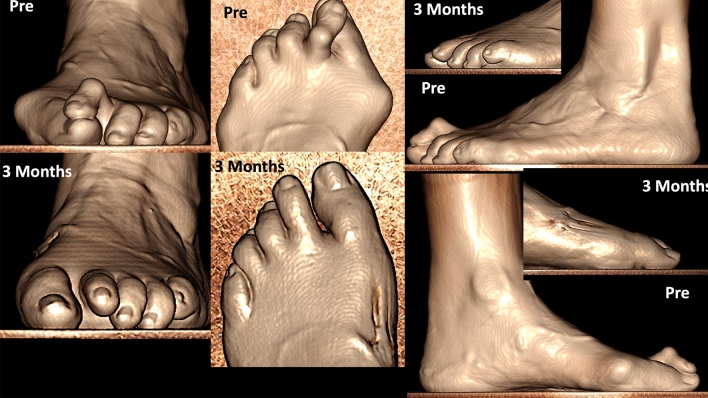 Fig. 12