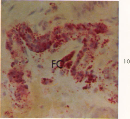 Fig. 10