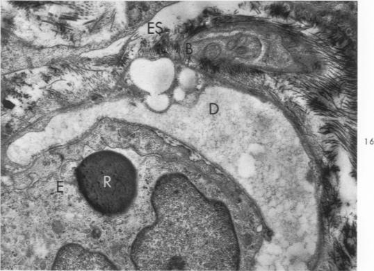 Fig. 16