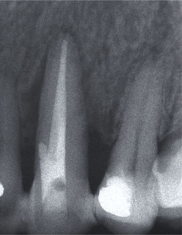 Figure 4B: