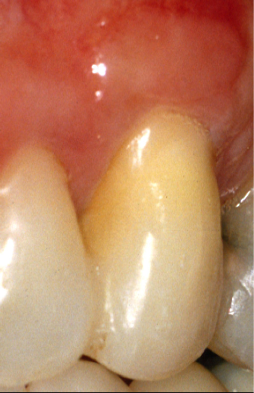 Figure 5A: