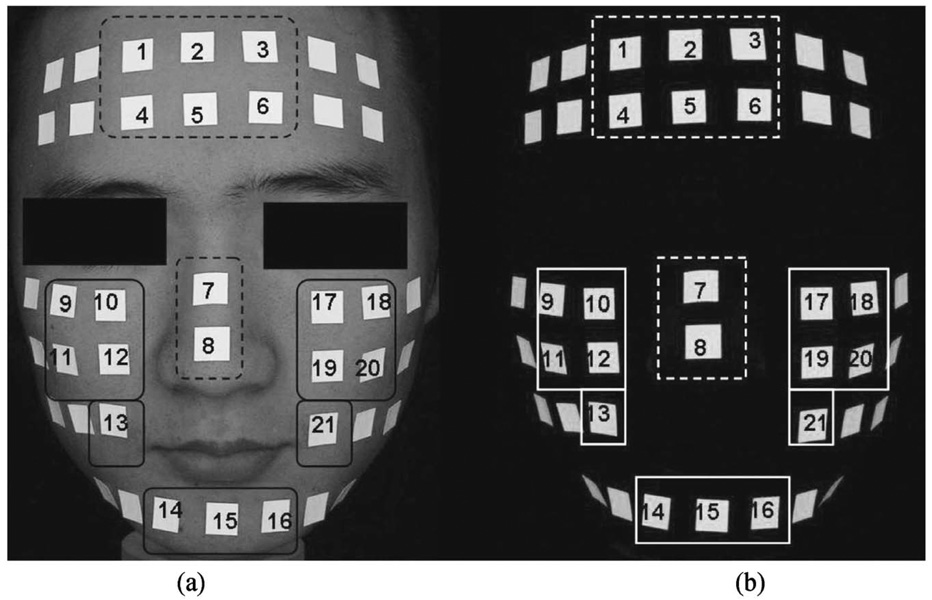 Fig. 2