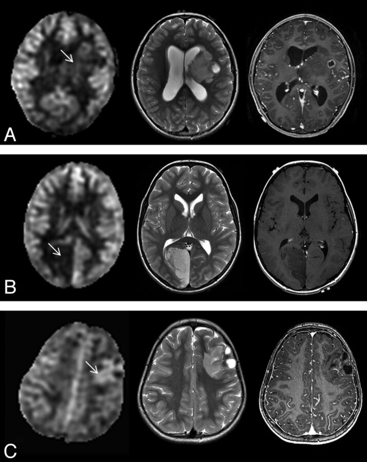 Fig 4.