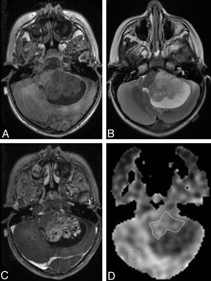 Fig 1.