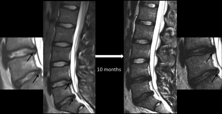 Fig 3.