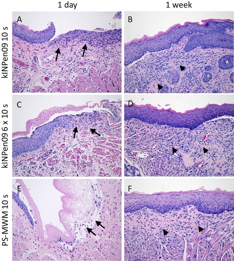 Fig 5