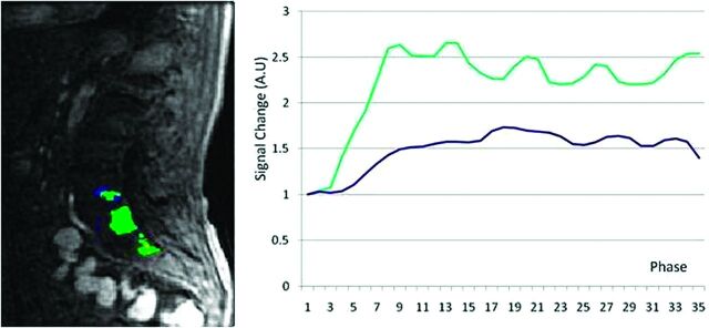 Fig 3.