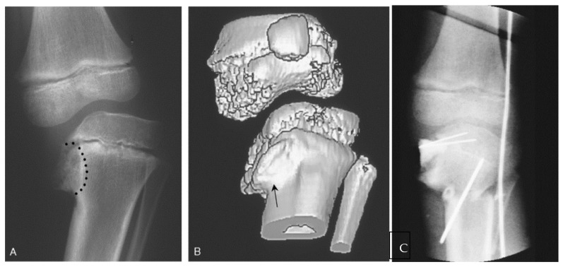 Figure 13