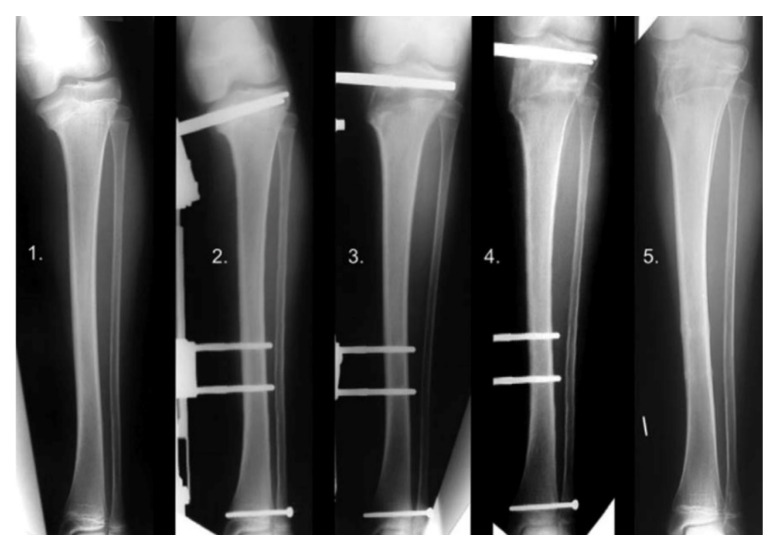 Figure 23