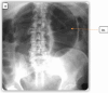 Fig. 1