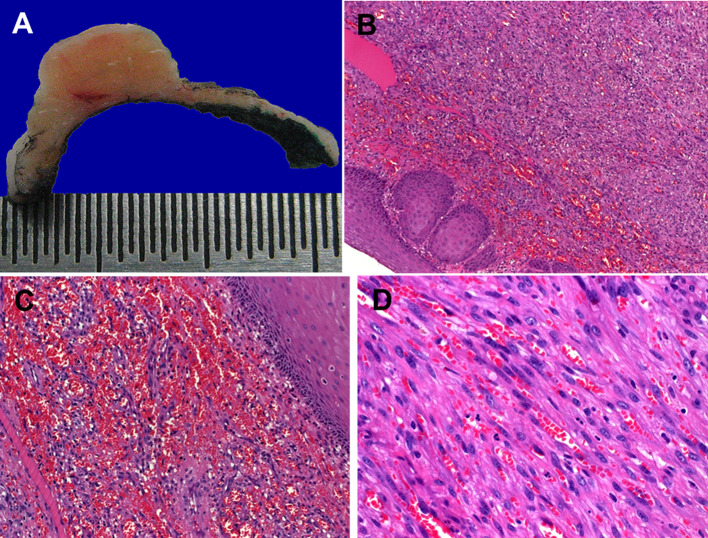 Fig. 2