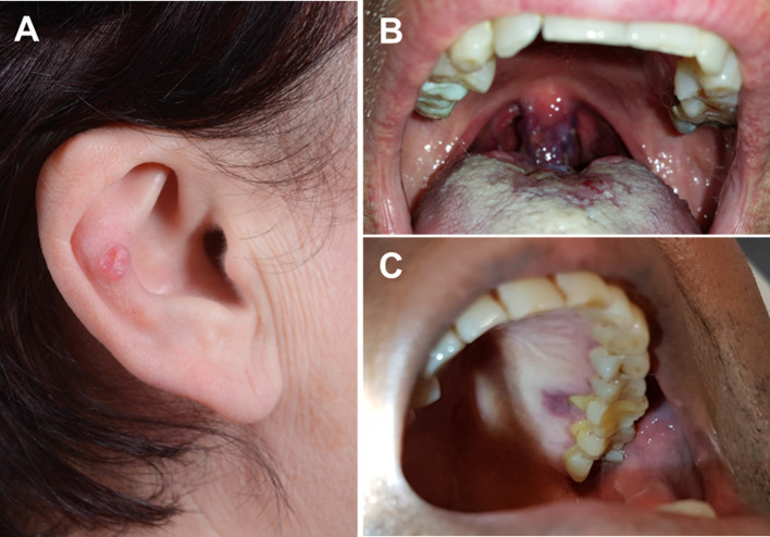 Fig. 1