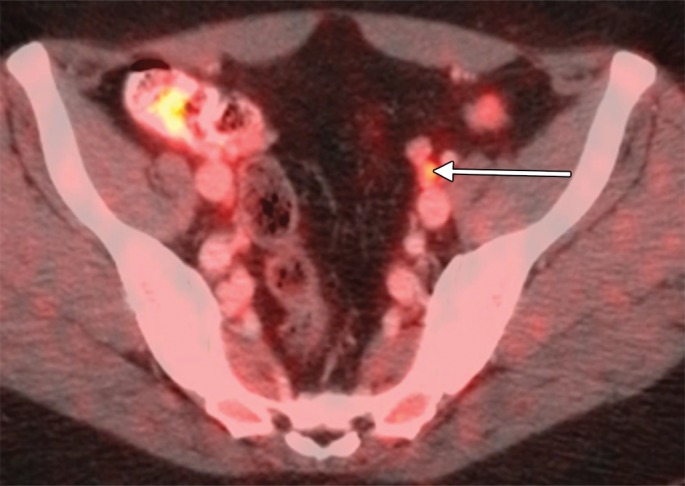 Figure 3b: