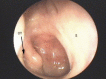 Fig. 11