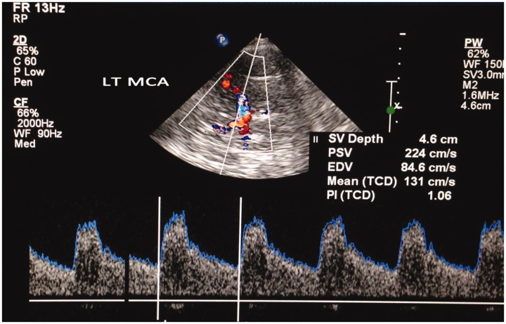 Figure 10.