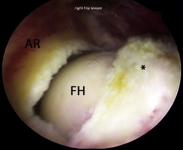 Fig 5