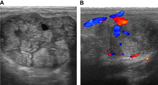 Figure 4