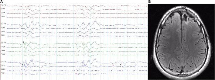 Figure 14